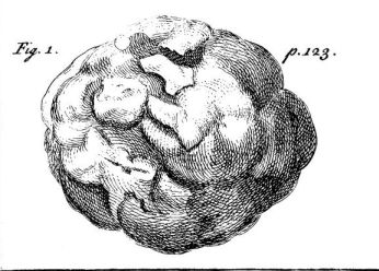 Pietra de mombazza, or Rhinoceros bezoar. Drawing January 1, 1753 from a letter; courtesy of Archive.org. 